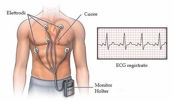 Holter cardiaco.jpg