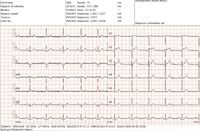 immagine ECG.jpg